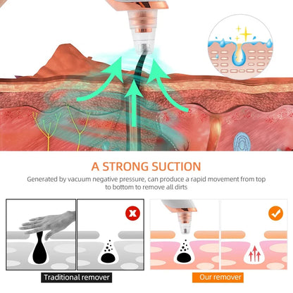 Electric Blackhead Remover Vacuum Suction Strong Black Spots Pore Acne Cleaner Machine Rechargeable Facial Nose Skin Care Tool