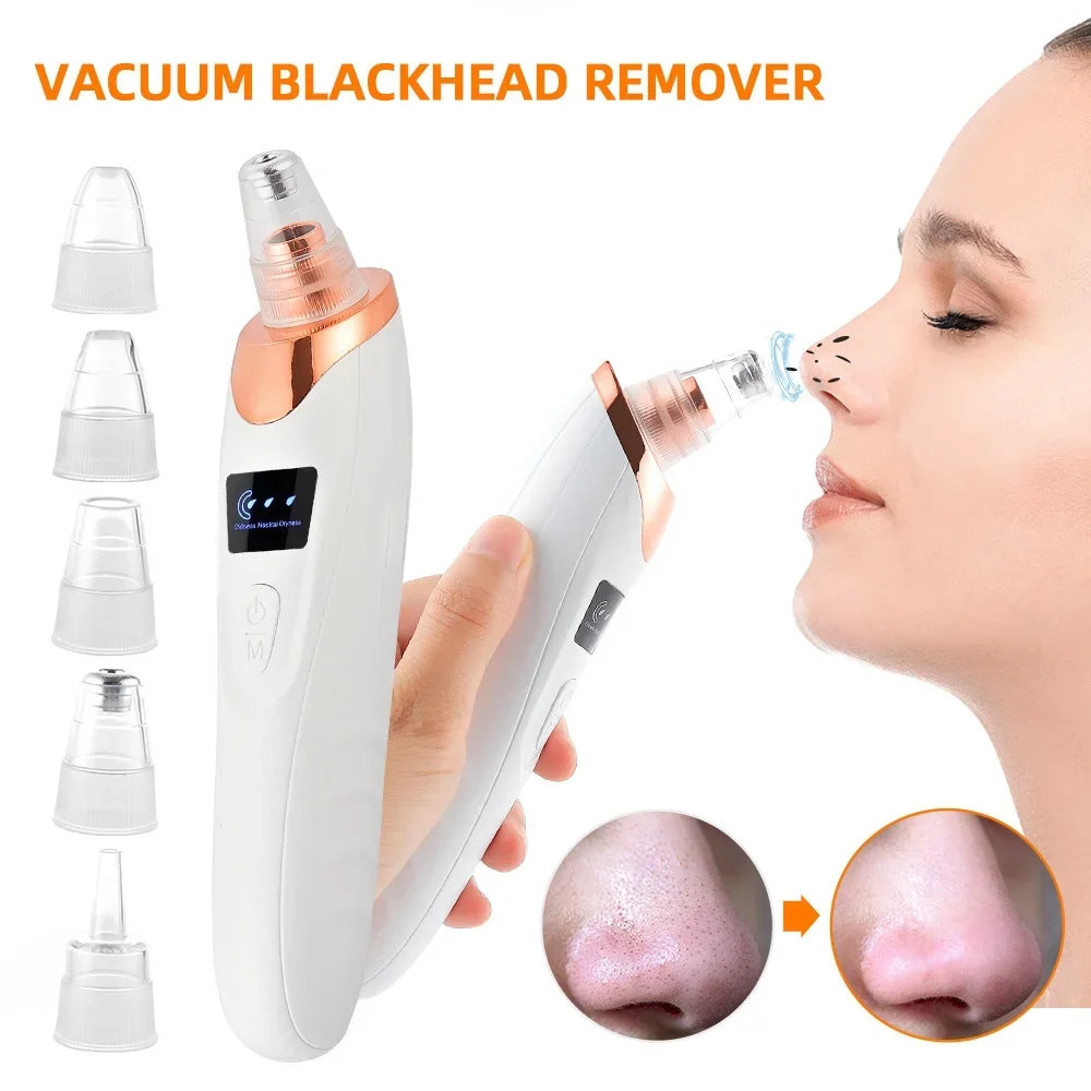 Electric Blackhead Remover Vacuum Suction Strong Black Spots Pore Acne Cleaner Machine Rechargeable Facial Nose Skin Care Tool